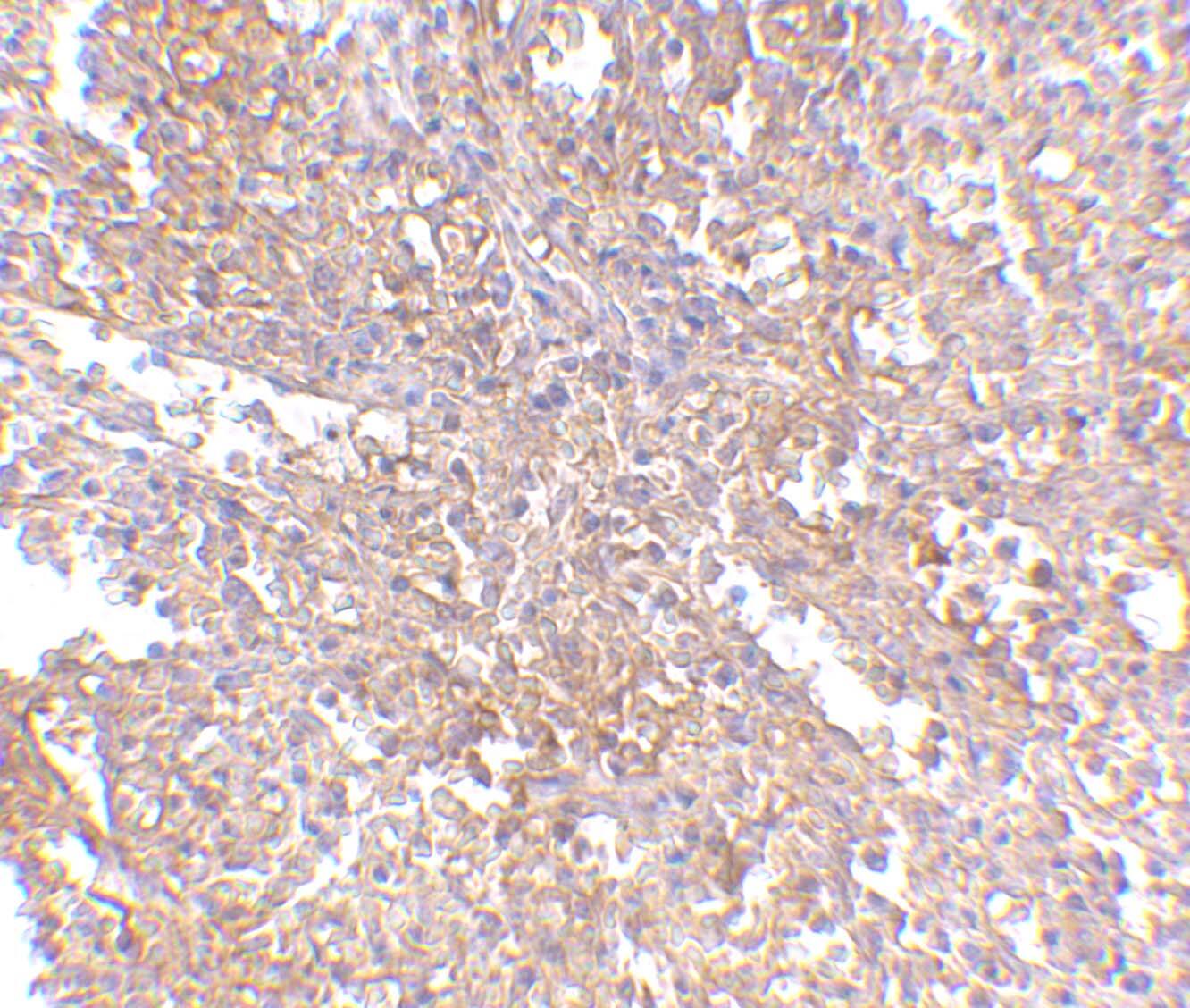 Immunohistochemistry: RAP80 Antibody - BSA Free [NBP1-76828] - Immunohistochemistry of RAP80 in human spleen tissue with RAP80 antibody at 2.5 u/mL.