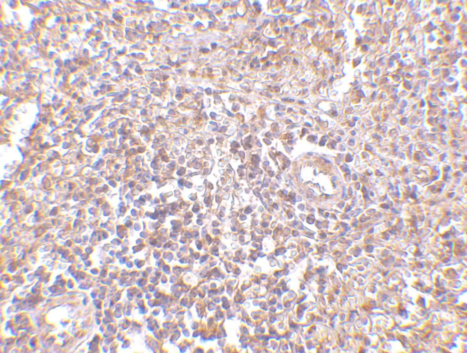 Immunohistochemistry: RAP80 Antibody - BSA Free [NBP1-76829] - Immunohistochemistry of RAP80 in human spleen tissue with RAP80 antibody at 2.5 u/mL.