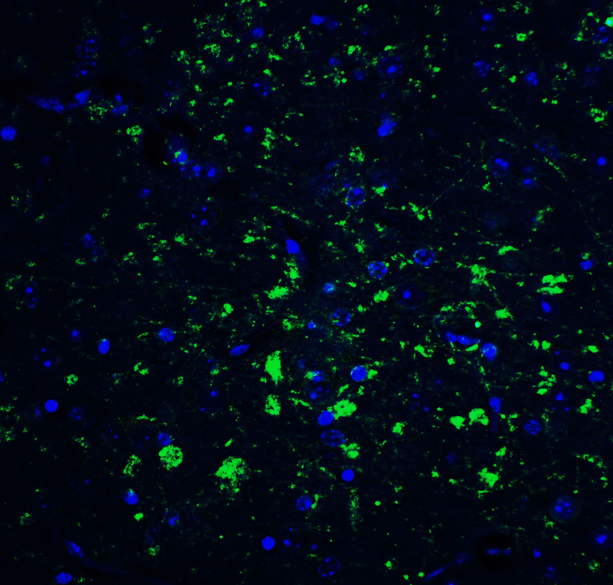 Immunocytochemistry/ Immunofluorescence CDNF Antibody - BSA Free