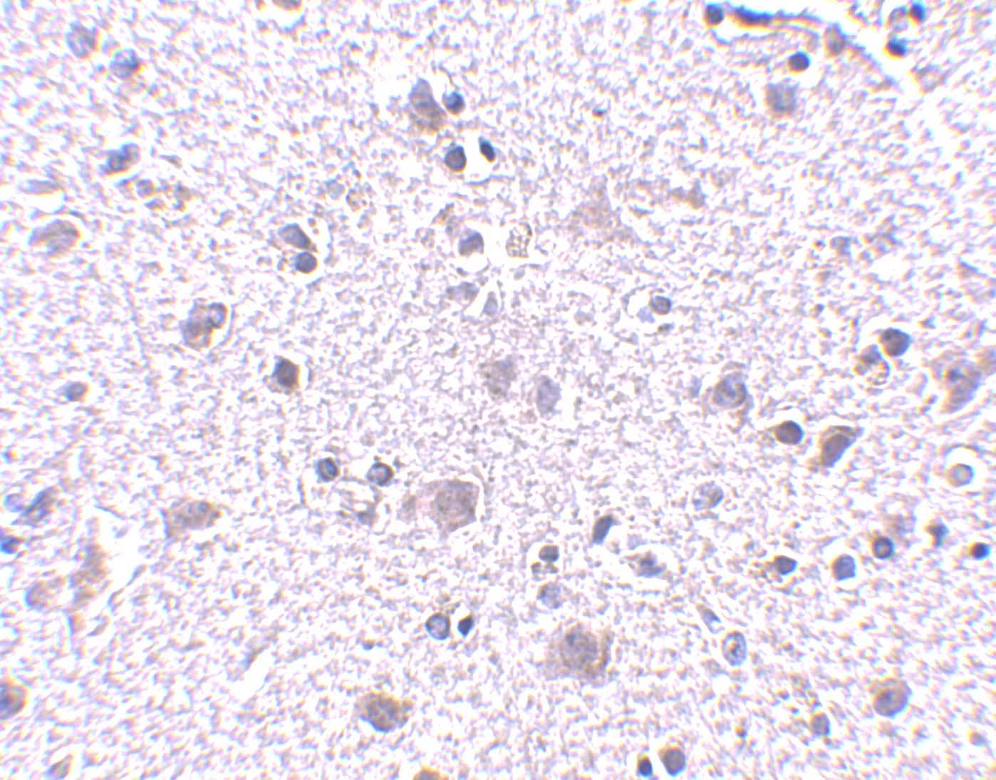 Immunohistochemistry: CDNF Antibody - BSA Free [NBP1-76835] - Immunohistochemistry of CDNF in human brain tissue with CDNF antibody at 5 ug/mL.