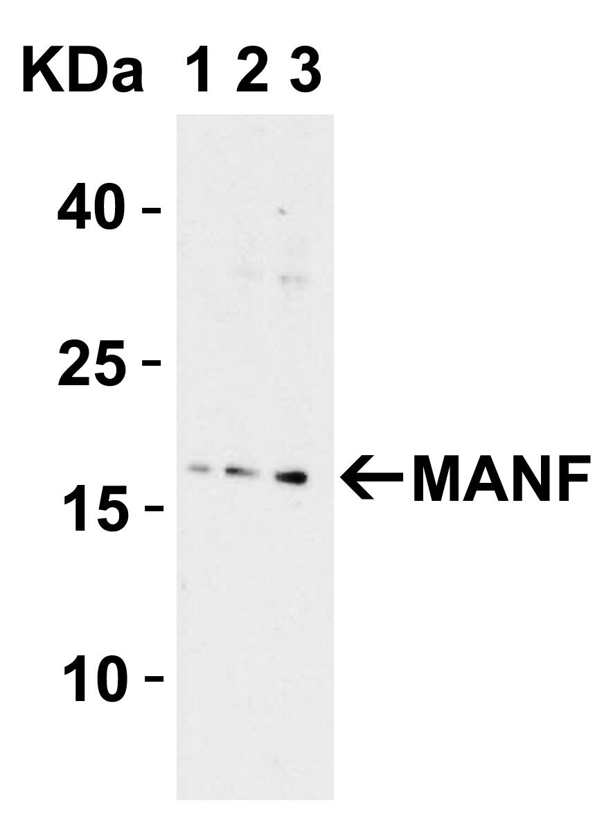 Western Blot: MANF Antibody - BSA Free [NBP1-76836] - Validation in Rat Liver.Loading: 15 ug of lysates per lane.Antibodies: MANF, 1h incubation at RT in 5% NFDM/TBST.Secondary: Goat anti-rabbit IgG HRP conjugate at 1:10000 dilution.Lane 1: 1 ug/mLLane 2: 2 ug/mLLane 3: 4 ug/mL