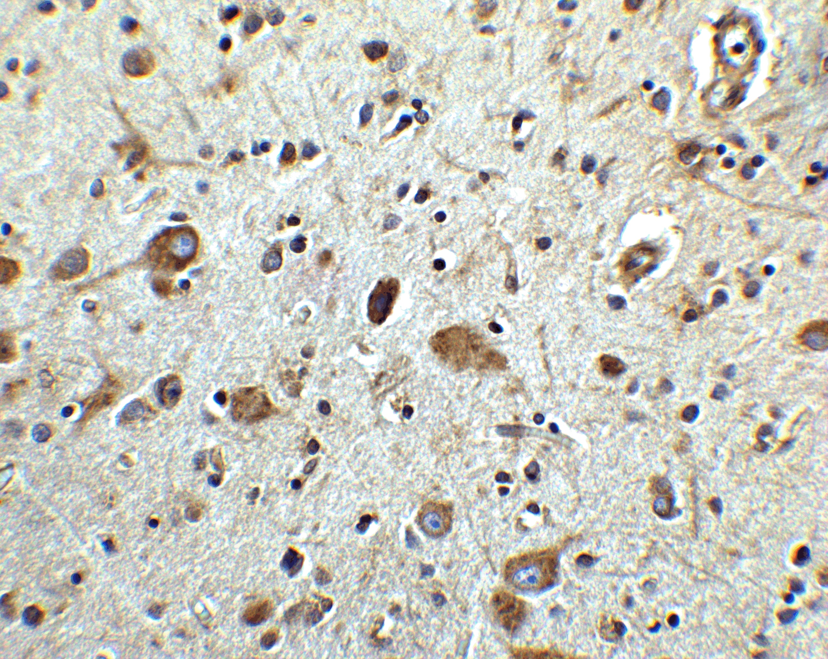 Immunohistochemistry: MANF Antibody - BSA Free [NBP1-76836] - Validation of MANF in Human Brain Tissue.Immunohistochemical analysis of paraffin-embedded human brain tissue using anti-MANF antibody  at 2.5 ug/ml. Tissue was fixed with formaldehyde and blocked with 10% serum for 1h at RT; antigen retrieval was by heat mediation with a citrate buffer (pH6). Samples were incubated with primary antibody overnight at 4C. A goat anti-rabbit IgG H&L (HRP) at 1/250 was used as secondary. Counter stained with Hematoxylin.