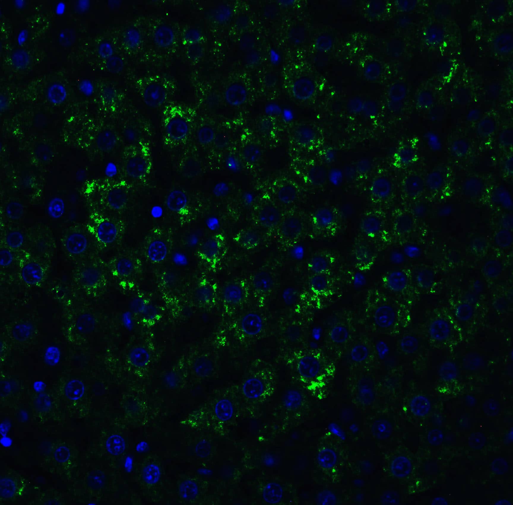 Immunocytochemistry/ Immunofluorescence: MANF Antibody - BSA Free [NBP1-76836] - Validation of MANF in Rat Liver.Immunofluorescent analysis of 4% paraformaldehyde-fixed rat liver cells labeling MANF with  at 20 ug/mL, followed by goat anti-rabbit IgG secondary antibody at 1/500 dilution (green) and DAPI antibody (blue).    