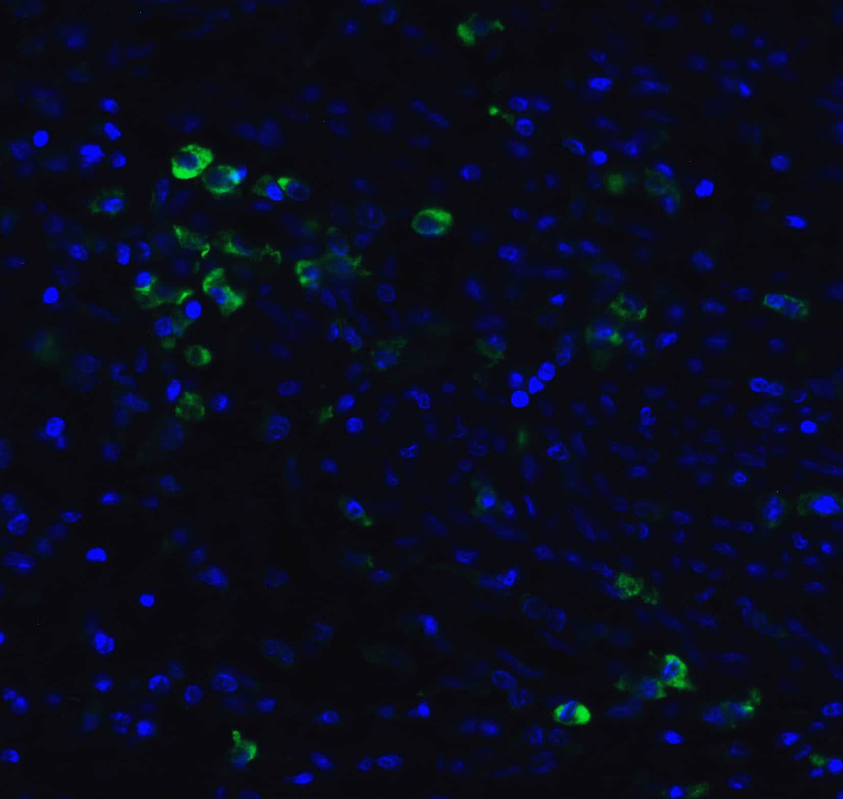 Immunocytochemistry/ Immunofluorescence: MANF Antibody - BSA Free [NBP1-76836] - Validation of MANF in Human Colon.Immunofluorescent analysis of 4% paraformaldehyde-fixed human colon cells labeling MANF with  at 5 ug/mL, followed by goat anti-rabbit IgG secondary antibody at 1/500 dilution (green) and DAPI antibody (blue).   