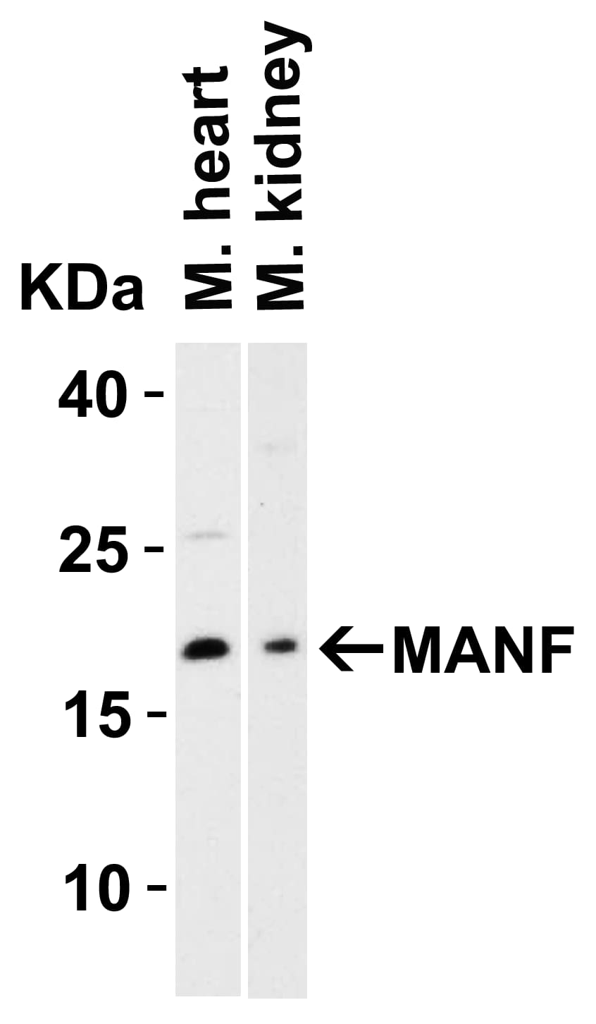 Western Blot: MANF Antibody - BSA Free [NBP1-76836] - Validation in Mouse TissuesLoading: 15 ug of lysates per lane.Antibodies: MANF, (2 ug/mL), 1h incubation at RT in 5% NFDM/TBST.Secondary: Goat anti-rabbit IgG HRP conjugate at 1:10000 dilution.