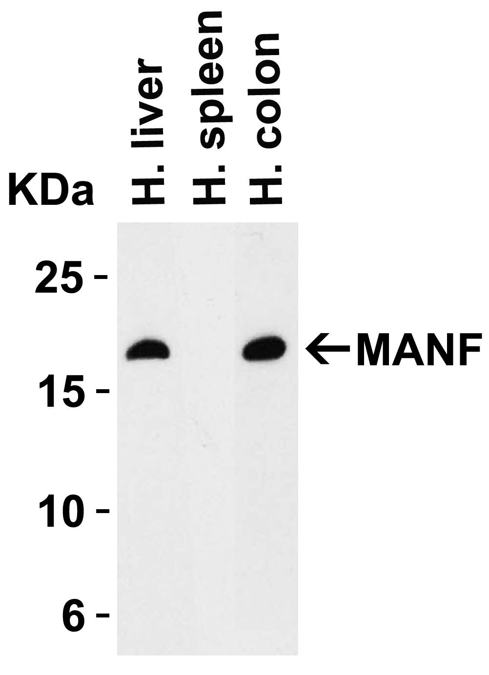 Western Blot: MANF Antibody - BSA Free [NBP1-76836] - Validation in Human Tissues.Loading: 15 ug of lysates per lane.Antibodies: MANF, (2 ug/mL), 1h incubation at RT in 5% NFDM/TBST.Secondary: Goat anti-rabbit IgG HRP conjugate at 1:10000 dilution.