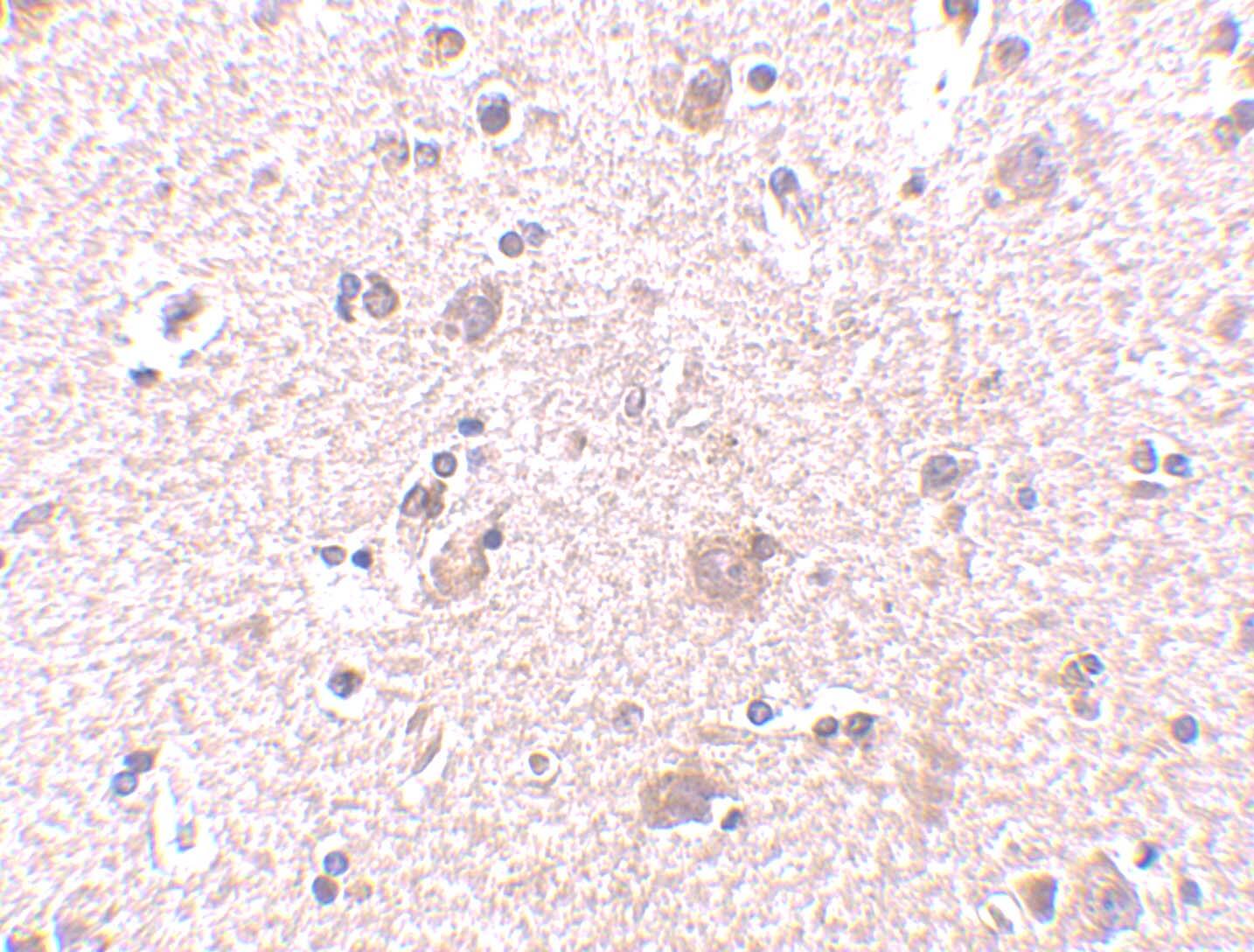 Immunohistochemistry: MANF Antibody - BSA Free [NBP1-76837] - Figure 4  Immunohistochemistry Validation of MANF in Human Brain Tissue  Immunohistochemical analysis of paraffin-embedded human brain tissue using anti-MANF antibody  at 2.5 u /ml. Tissue was fixed with formaldehyde and blocked with 10% serum for 1 h at RT; antigen retrieval was by heat mediation with a citrate buffer (pH6). Samples were incubated with primary antibody overnight at 4;C. A goat anti-rabbit IgG H&L (HRP) at 1/250 was used as secondary. Counter stained with Hematoxylin.