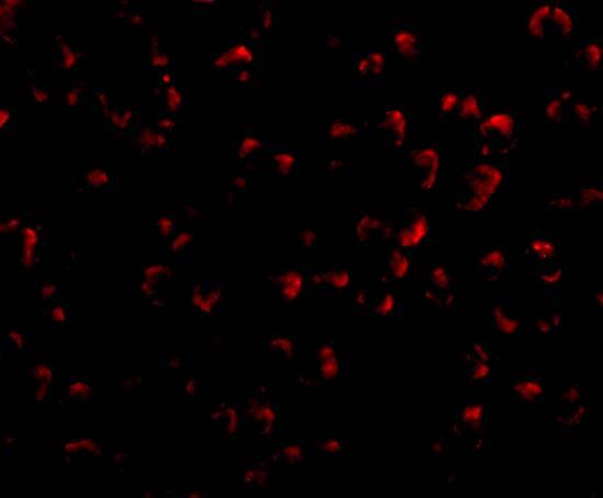 Immunocytochemistry/ Immunofluorescence: RYBP/DEDAF Antibody - BSA Free [NBP1-76842] - Immunofluorescence of RYBP/DEDAF in A549 cells with RYBP/DEDAF antibody at 20 u/mL.