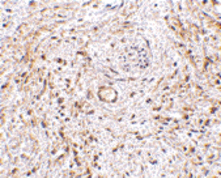 Immunohistochemistry: TEM5/GPR124 Antibody - BSA Free [NBP1-76844] - Immunohistochemistry of TEM5/GPR124 in human bladder tissue with TEM5/GPR124 antibody at 5 ug/mL.