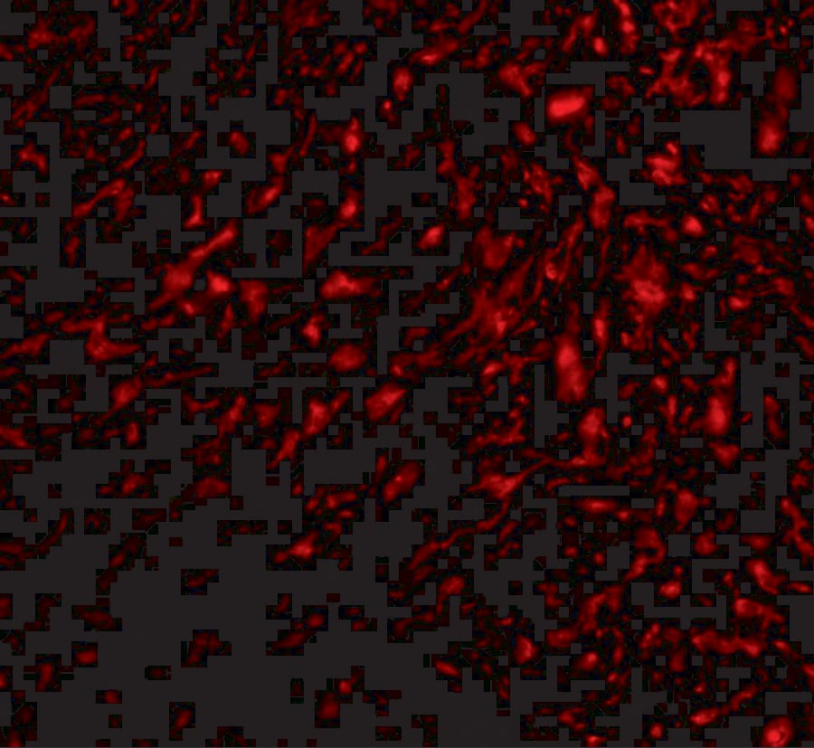 Immunocytochemistry/ Immunofluorescence: TEM5/GPR124 Antibody - BSA Free [NBP1-76844] - Immunofluorescence of TEM5/GPR124 in human bladder tissue with TEM5/GPR124 antibody at 20 ug/mL.