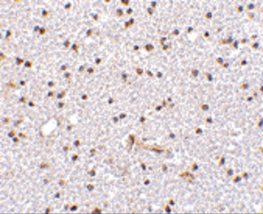 Immunohistochemistry: FNBP1L Antibody - BSA Free [NBP1-76845] - Immunohistochemistry of FNBP1L in human brain tissue with FNBP1L antibody at 2.5 u/mL.