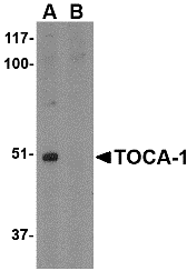 Western Blot: FNBP1L Antibody - BSA Free [NBP1-76845] - Western blot analysis of FNBP1L in mouse brain tissue lysate with in (A) the absence and (B) the presence of blocking peptide with FNBP1L antibody at 1 u/mL.