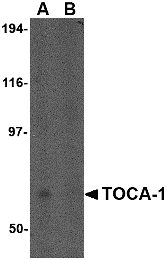 Western Blot: FNBP1L Antibody - BSA Free [NBP1-76846] - Western blot analysis of FNBP1L in human brain tissue lysate in (A) the absence and (B) the presence of blocking peptide with FNBP1L antibody at 0.5 u/mL.