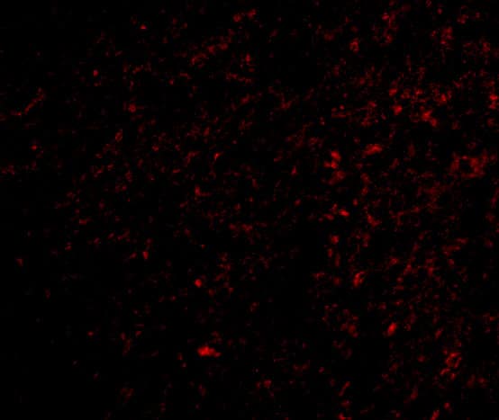 Immunocytochemistry/ Immunofluorescence: FNBP1L Antibody - BSA Free [NBP1-76846] - Immunofluorescence of FNBP1L in Human Brain cells with FNBP1L antibody at 20 u/mL.