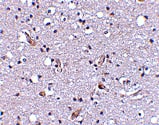 Immunohistochemistry NHE1/SLC9A1 Antibody - BSA Free