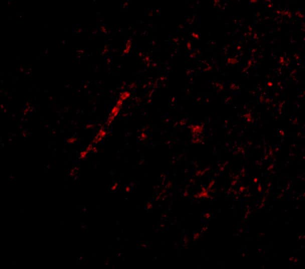 Immunocytochemistry/ Immunofluorescence: NHE1/SLC9A1 Antibody - BSA Free [NBP1-76847] - Immunofluorescence of NHE1/SLC9A1 in Human Brain tissue with NHE1/SLC9A1 antibody at 20 u/mL.