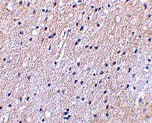 Immunohistochemistry: NHE1/SLC9A1 Antibody - BSA Free [NBP1-76848] - Immunohistochemical staining of human brain tissue using NHE1/SLC9A1 antibody at 2.5 u/mL.