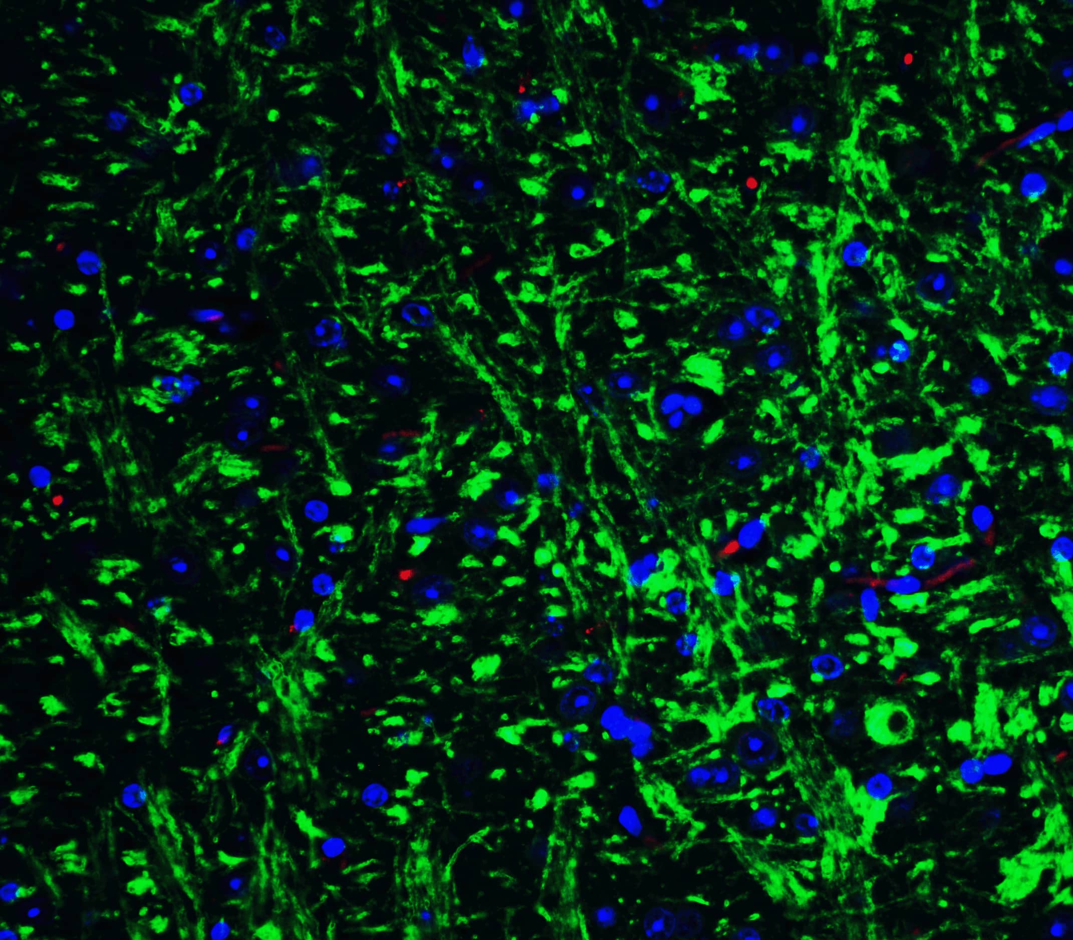 Immunocytochemistry/ Immunofluorescence GluR5/GRIK1 Antibody - BSA Free