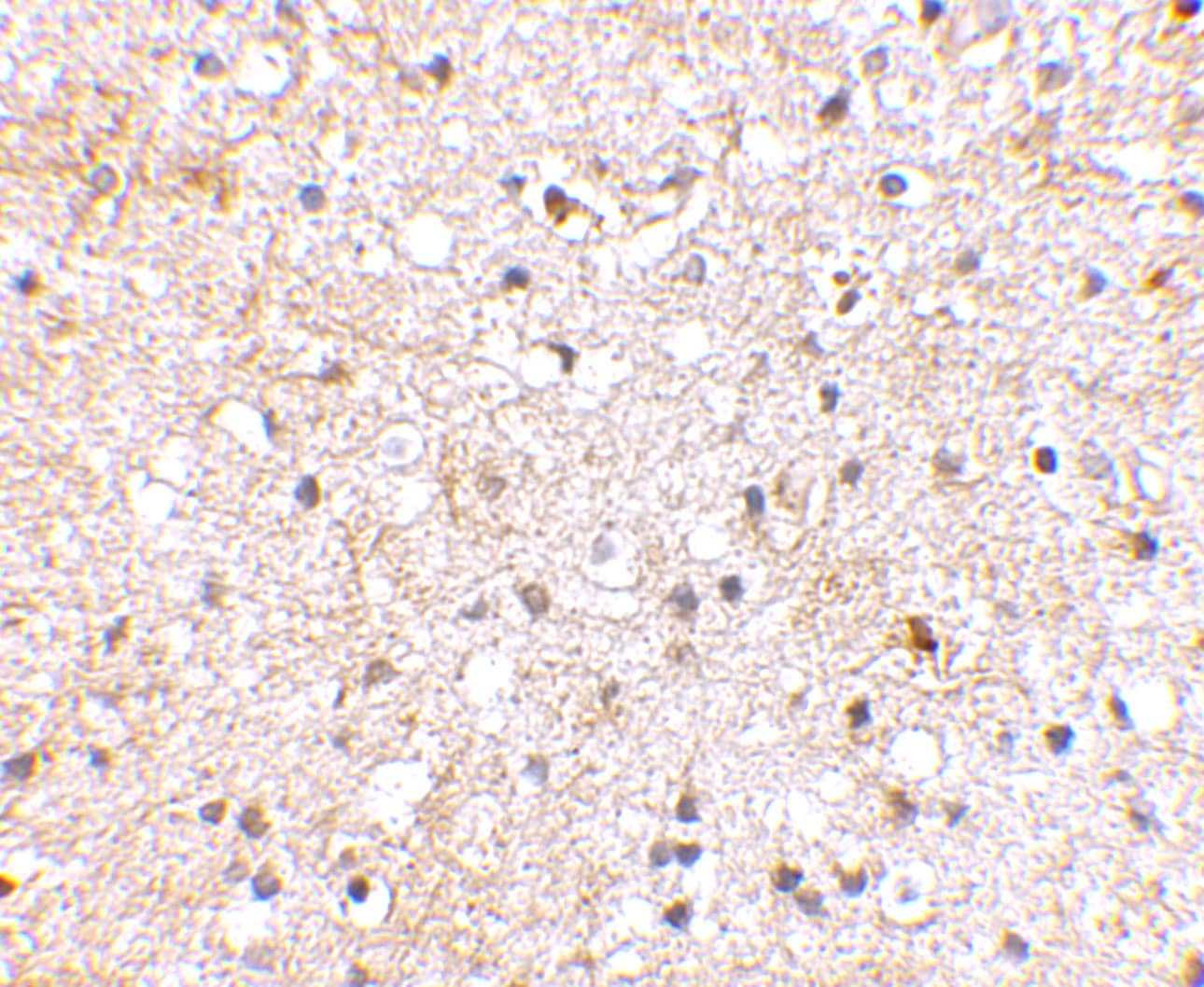 Immunohistochemistry GluR5/GRIK1 Antibody - BSA Free