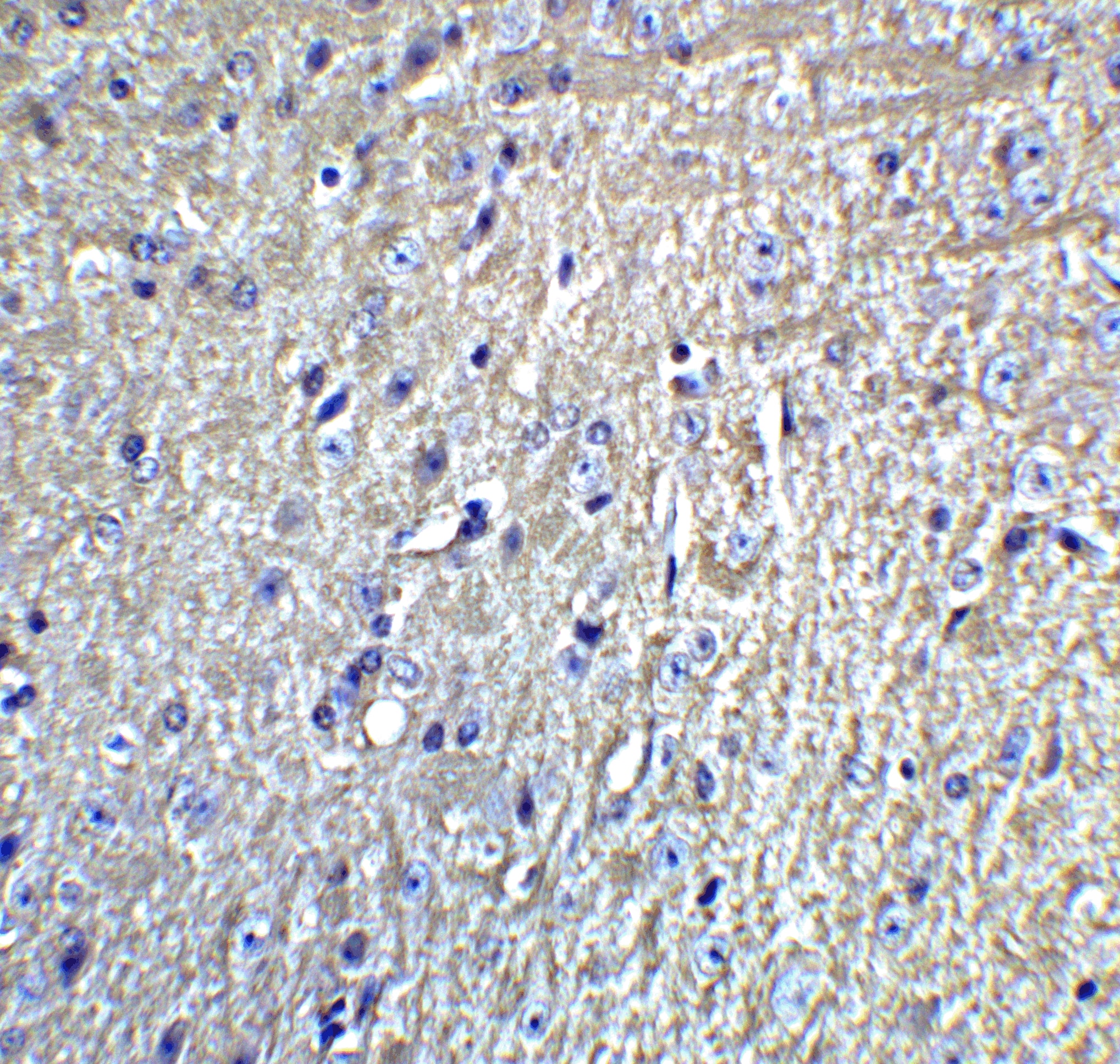 Immunohistochemistry GluR5/GRIK1 Antibody - BSA Free