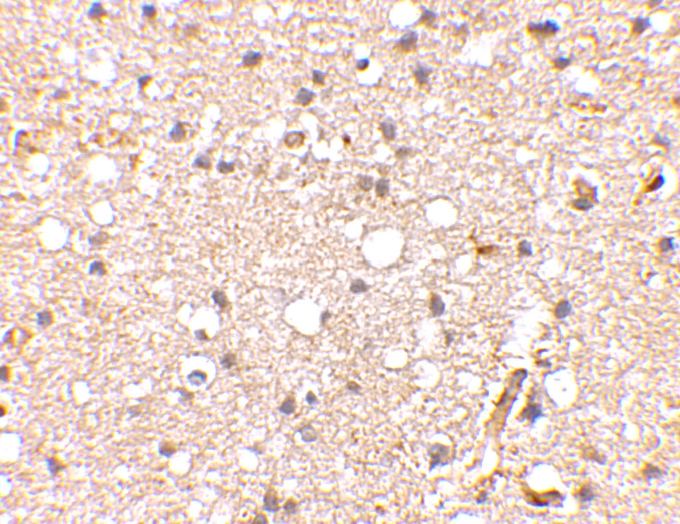 Immunohistochemistry: GluR5/GRIK1 Antibody - BSA Free [NBP1-76850] - Immunohistochemical staining of human brain tissue using GluR5/GRIK1 antibody at 2.5 u/mL.