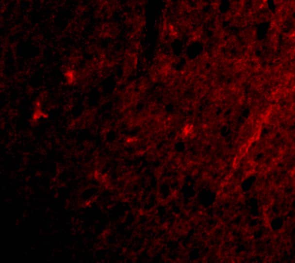 Immunocytochemistry/ Immunofluorescence: GluR5/GRIK1 Antibody - BSA Free [NBP1-76850] - Immunofluorescence of GluR5/GRIK1 in Human Brain cells with GluR5/GRIK1 antibody at 20 u/mL.