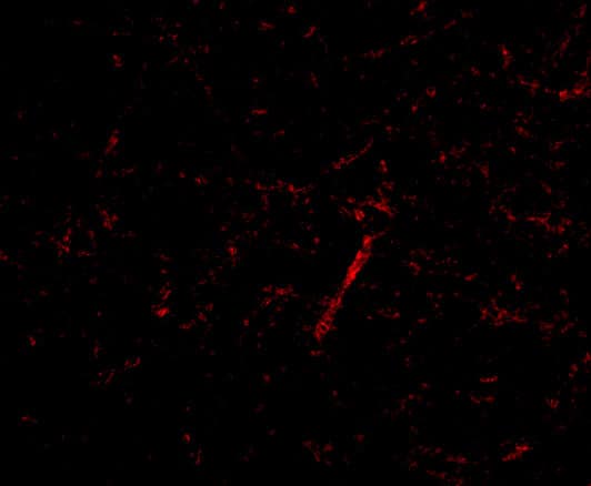 Immunocytochemistry/ Immunofluorescence: KA1/GRIK4/Glutamate Receptor KA1 Antibody - BSA Free [NBP1-76852] - Immunofluorescence of KA1/GRIK4/Glutamate Receptor KA1 in Human Brain cells with KA1/GRIK4/Glutamate Receptor KA1 antibody at 20 ug/mL.