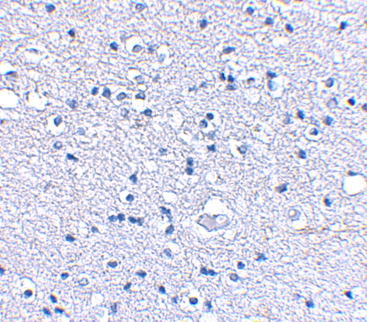 Immunohistochemistry: KA1/GRIK4/Glutamate Receptor KA1 Antibody - BSA Free [NBP1-76852] - Immunohistochemical staining of human brain tissue using KA1/GRIK4/Glutamate Receptor KA1 antibody at 2.5 ug/mL.