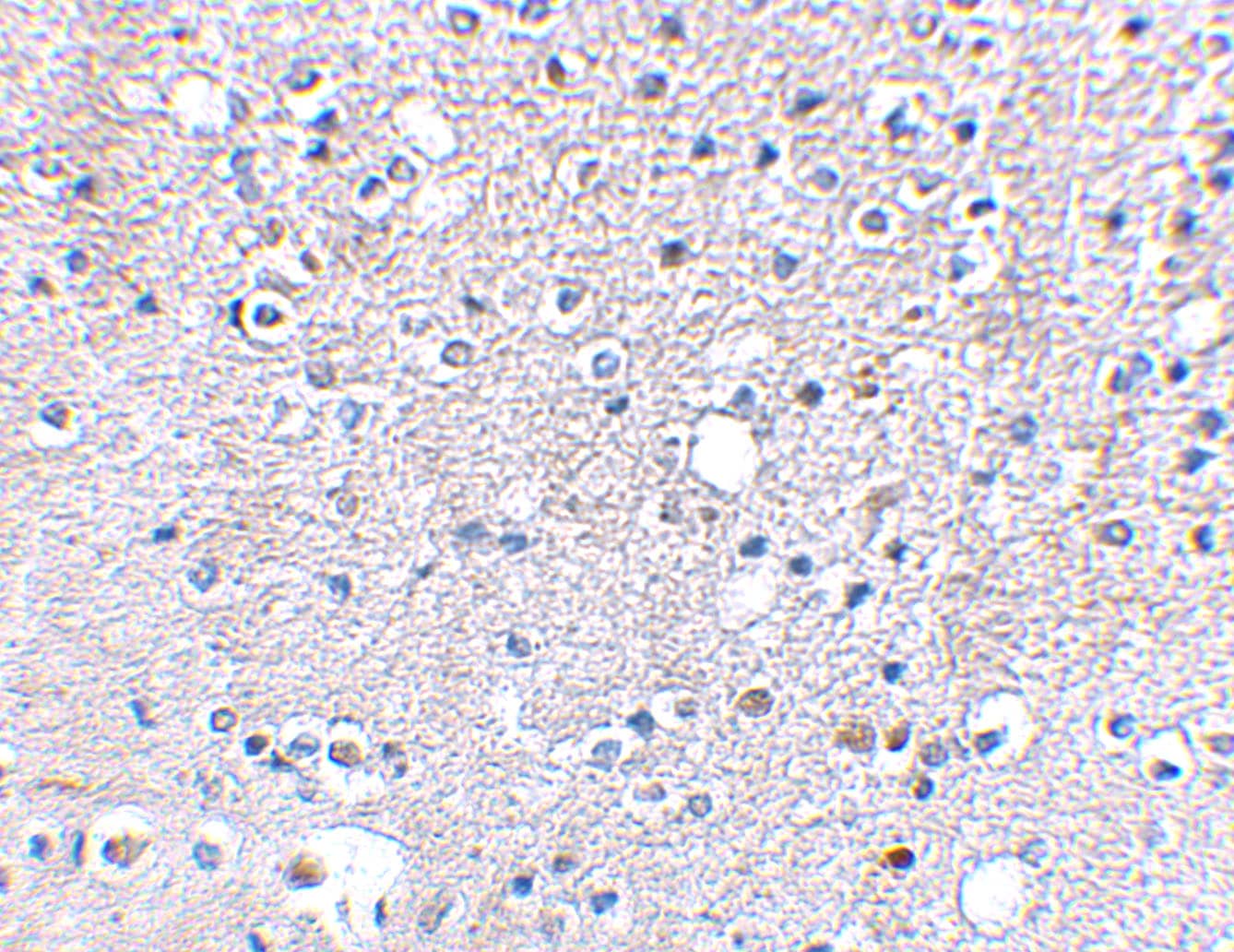 Immunohistochemistry KA2/GRIK5/Glutamate Receptor KA2 Antibody - BSA Free