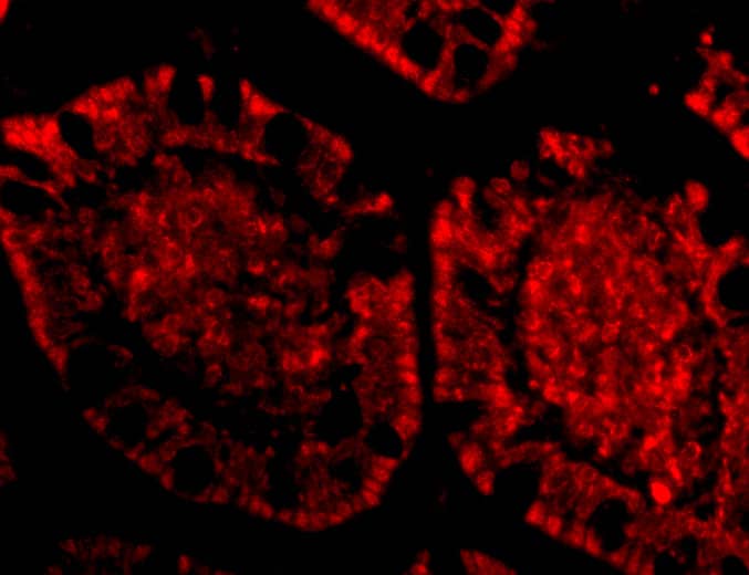 Immunocytochemistry/ Immunofluorescence: ZBP1/DLM-1/DAI Antibody - BSA Free [NBP1-76854] - Immunofluorescence of ZBP1/DLM-1/DAI in Human Small Intestine tissue with ZBP1/DLM-1/DAI antibody at 20 ug/mL.