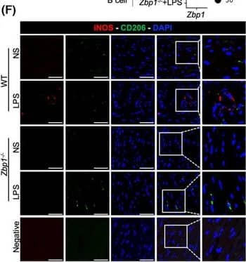 Immunocytochemistry/ Immunofluorescence ZBP1/DLM-1/DAI Antibody - BSA Free