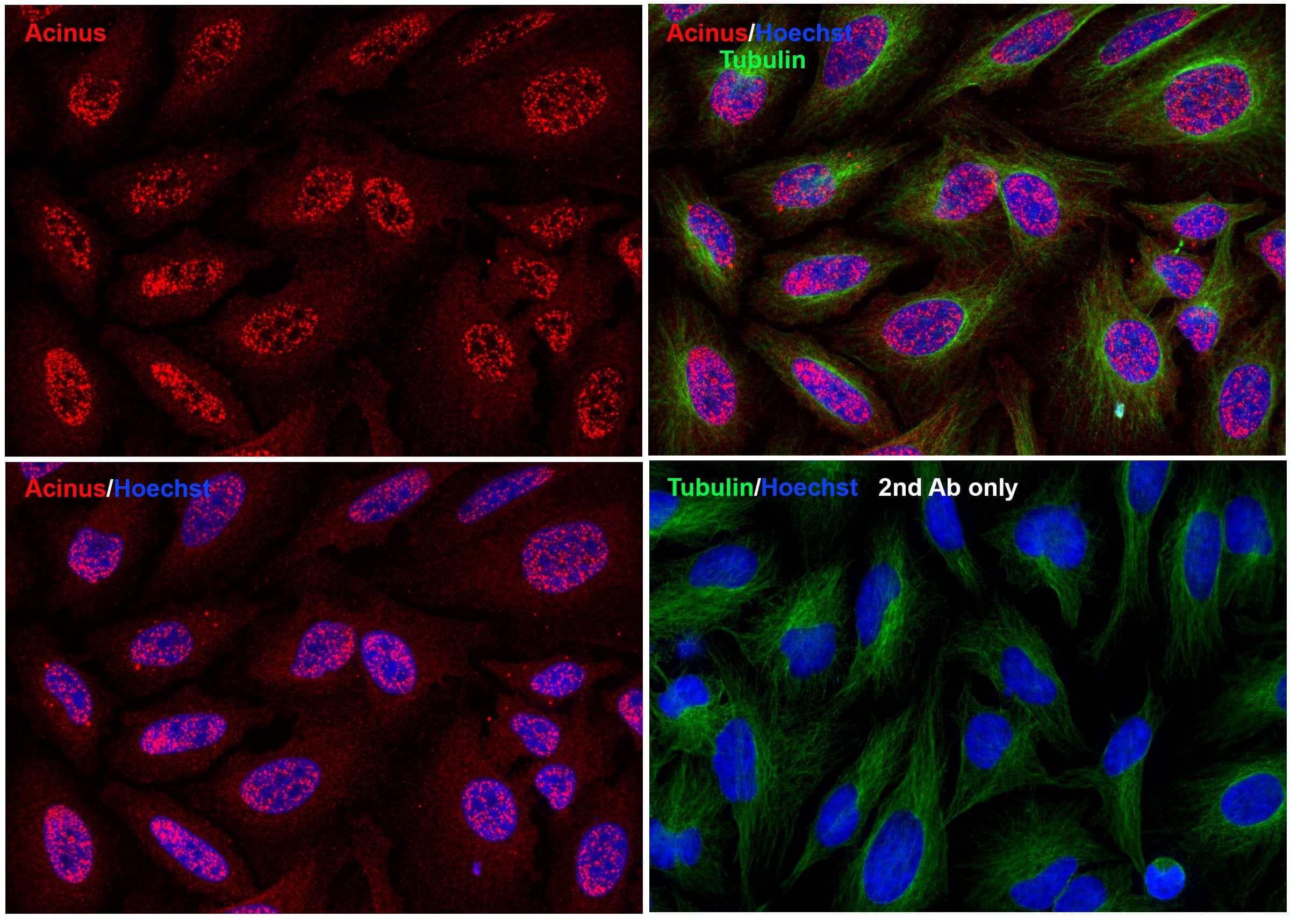 Immunocytochemistry/ Immunofluorescence Acinus Antibody - BSA Free