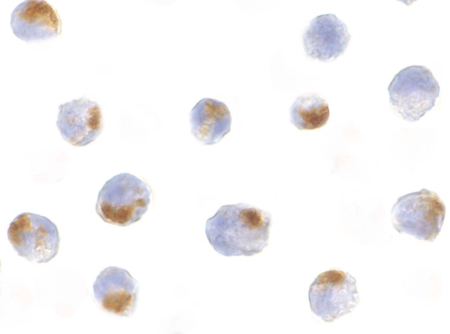 Immunocytochemistry/ Immunofluorescence: Acinus Antibody - BSA Free [NBP1-76855] - Immunocytochemistry of Acinus in K562 cells with Acinus antibody at 5 ug/mL.