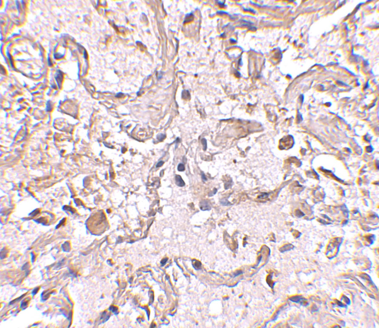 Immunohistochemistry: Glutathione S-Transferase pi 1/GSTP1 Antibody - BSA Free [NBP1-76857] - Immunohistochemical staining of human lung tissue using Glutathione S-Transferase pi 1/GSTP1 antibody at 2.5 ug/mL.