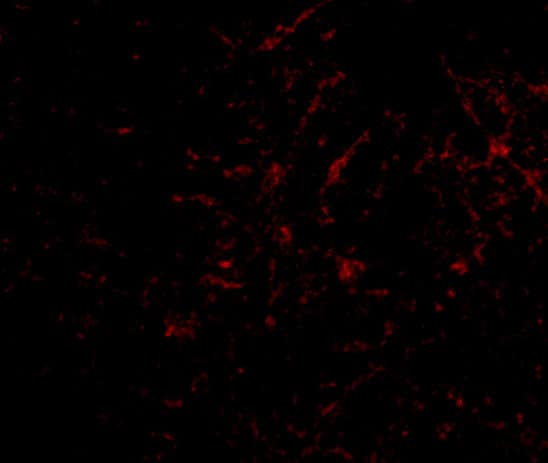 Immunocytochemistry/ Immunofluorescence: Plxdc2 Antibody - BSA Free [NBP1-76859] - Immunofluorescence of Plxdc2 in Human Brain cells with Plxdc2 antibody at 50 ug/mL.