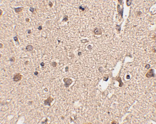 Immunohistochemistry: ATG12 Antibody - BSA Free [NBP1-76860] - Immunohistochemistry of ATG12 in human brain tissue with ATG12 antibody at 2.5 u/mL. 