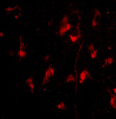 Immunocytochemistry/ Immunofluorescence: ATG12 Antibody - BSA Free [NBP1-76860] - Immunofluorescence of ATG12 in Human Brain cells with ATG12 antibody at 20 u/mL.