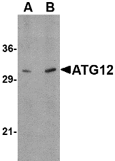 Western Blot: ATG12 Antibody - BSA Free [NBP1-76860] - Western blot analysis of ATG12 in human brain tissue lysate with ATG12 antibody at (A) 0.5, and (B) 1 u/mL.