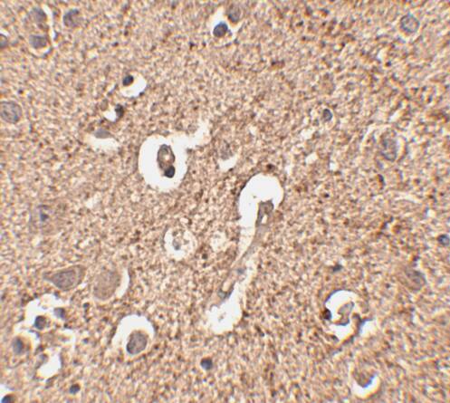 Immunohistochemistry: ATG12 Antibody - BSA Free [NBP1-76861] - Immunohistochemistry of ATG12 in human brain tissue with ATG12 antibody at 2.5 u/mL.