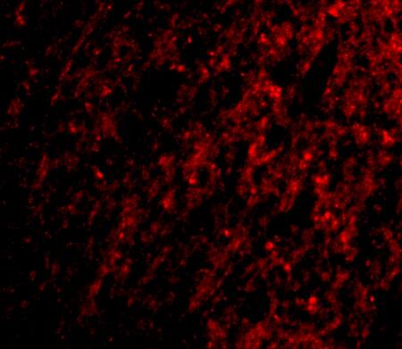 Immunocytochemistry/ Immunofluorescence: ATG12 Antibody - BSA Free [NBP1-76861] - Immunofluorescence of ATG12 in Human Brain cells with ATG12 antibody at 20 u/mL.