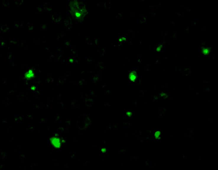 Immunocytochemistry/ Immunofluorescence: Acinus Antibody - BSA Free [NBP1-76869] - Immunofluorescence of Acinus in Hela cells with Acinus antibody at 10 ug/mL.