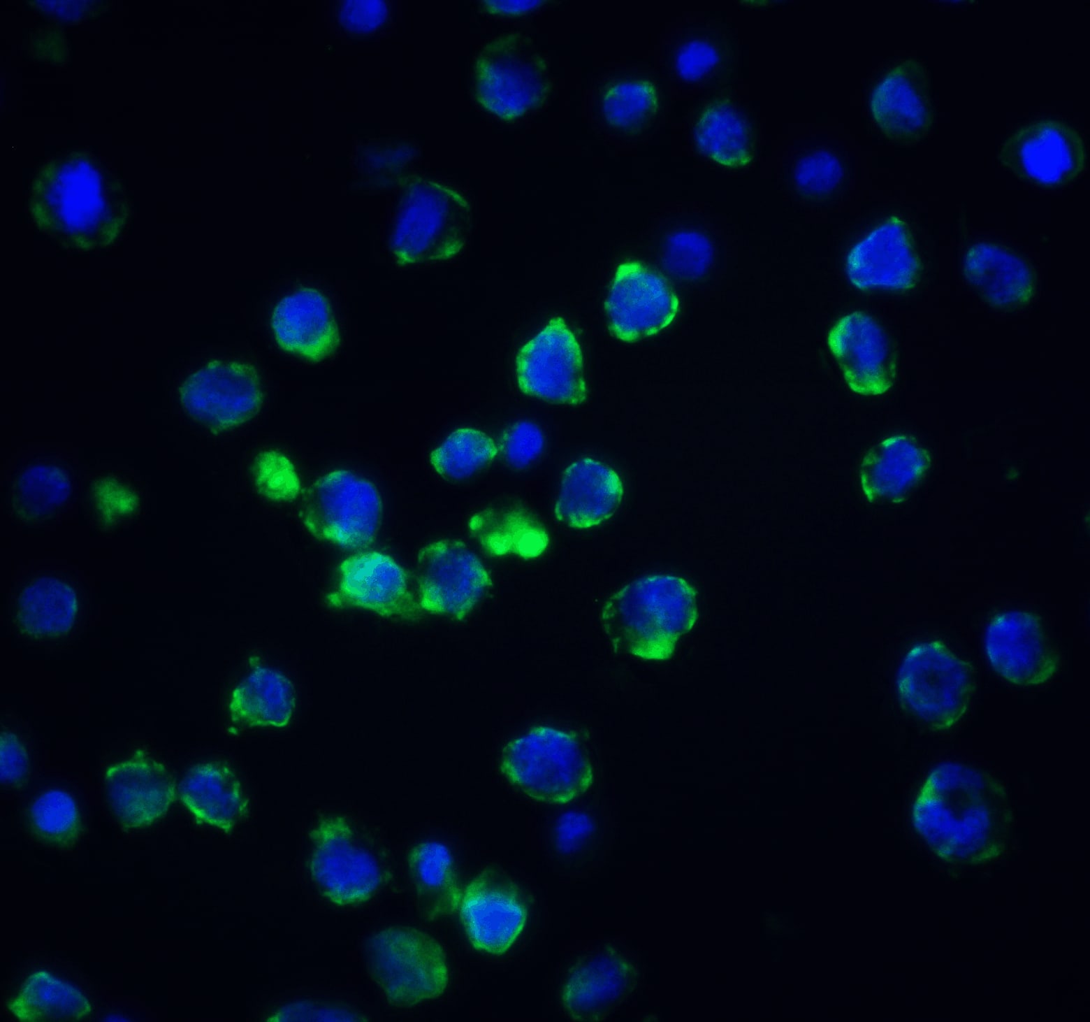 Immunocytochemistry/ Immunofluorescence: Acinus Antibody - BSA Free [NBP1-76869] - Immunofluorescence of Acinus in K562 cells with Acinus antibody at 20 ug/ml.Green: Acinus Antibody   Blue: DAPI staining