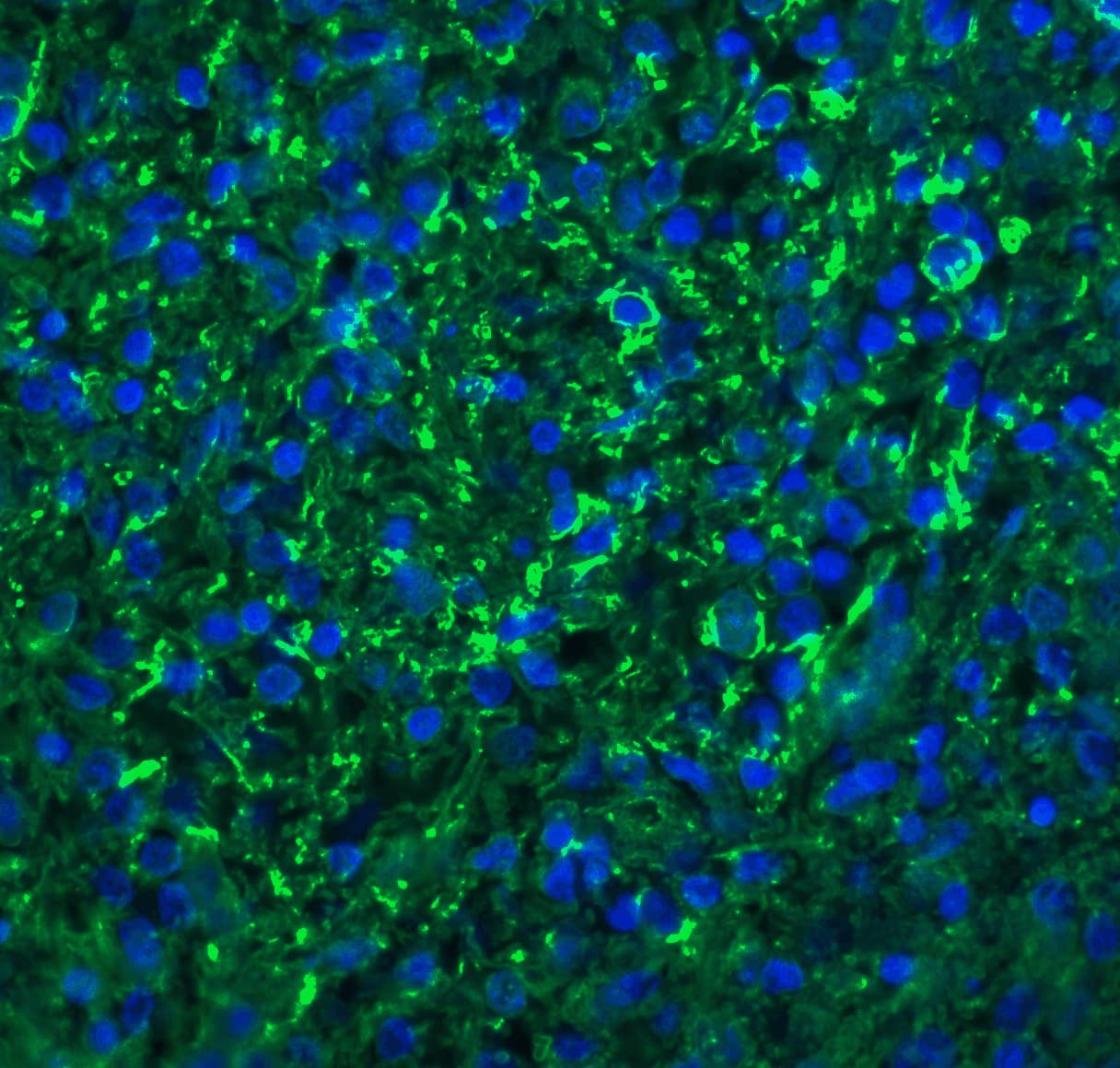 Immunocytochemistry/ Immunofluorescence: CXCR6 Antibody - BSA Free [NBP1-76871] - Immunofluorescence of CXCR6 in human spleen tissue with CXCR6 antibody at 20 ug/ml.Green: CXCR6 Antibody   Blue: DAPI staining
