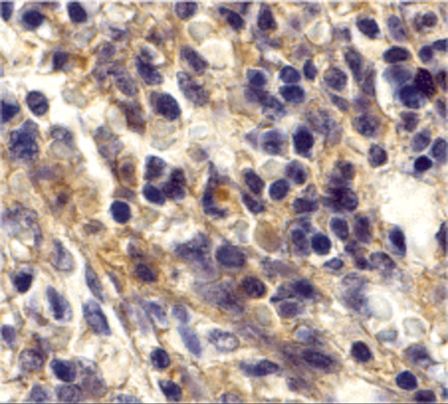 Immunohistochemistry: CXCR6 Antibody - BSA Free [NBP1-76871] - Immunohistochemistry of CXCR6 in human spleen tissue with CXCR6 antibody at 20 ug/mL.