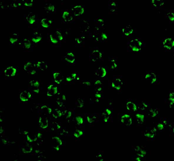 Immunocytochemistry/ Immunofluorescence: RIPK2 Antibody - BSA Free [NBP1-76873] - Immunofluorescence of RIPK2 in K562 cells with RIPK2 antibody at 20 u/mL.