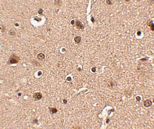 Immunohistochemistry: SLITRK4 Antibody - BSA Free [NBP1-76875] - Immunohistochemistry of SLITRK4 in human brain tissue with SLITRK4 antibody at 2.5 u/mL.