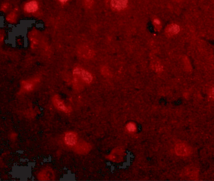 Immunocytochemistry/ Immunofluorescence: SLITRK4 Antibody - BSA Free [NBP1-76875] - Immunofluorescence of slitrk4 in human brain tissue with slitrk4 antibody at 20 ug/mL.