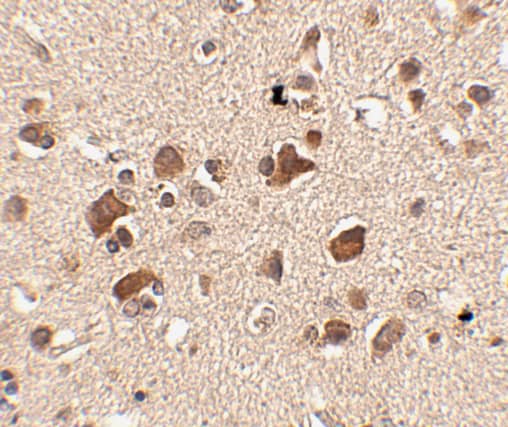 Immunohistochemistry SLITRK6 Antibody - BSA Free