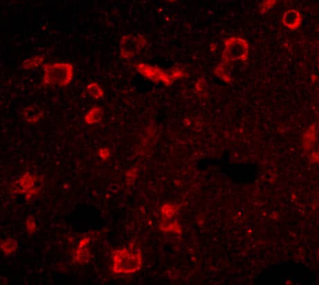 Immunocytochemistry/ Immunofluorescence SLITRK6 Antibody - BSA Free