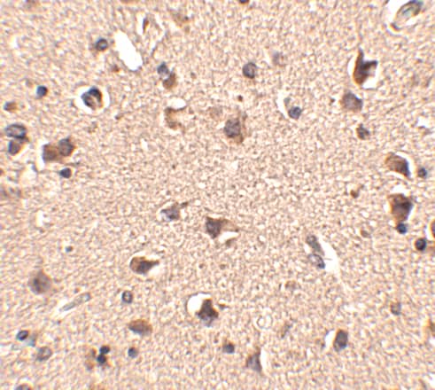 Immunohistochemistry: SLITRK6 Antibody - BSA Free [NBP1-76877] - Immunohistochemistry of SLITRK6 in human brain tissue with SLITRK6 antibody at 2.5 ug/mL.